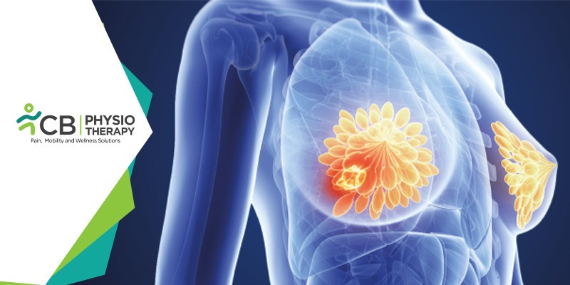 10 Best Exercises For Breast Cancer Patients