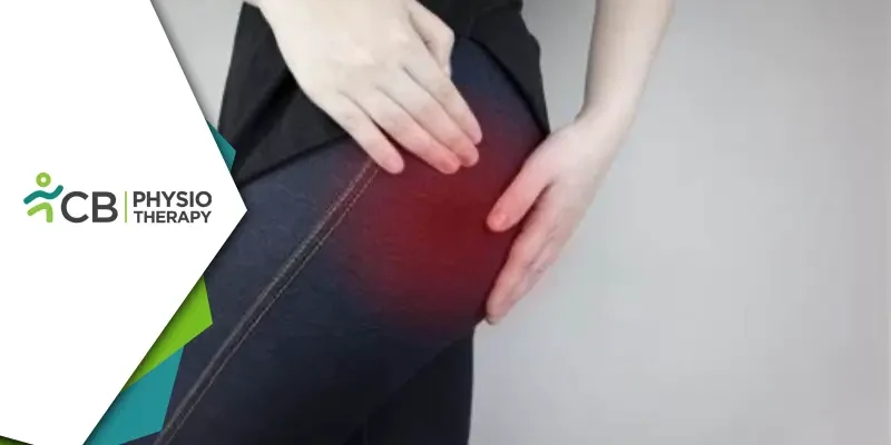 Piriformis Syndrome Relief | Unveiling The Vital Role Of Physiotherapy In Pain Management